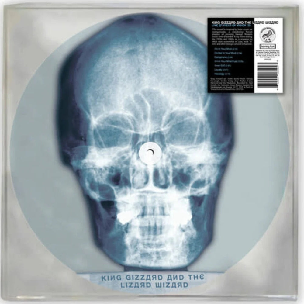 Skull X-Ray